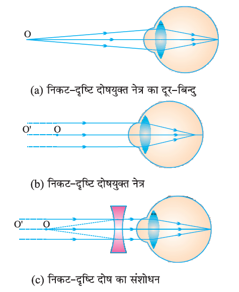 मानव नेत्र तथा रंगबिरंगा संसार
